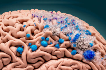 Microplastic-Brain-1